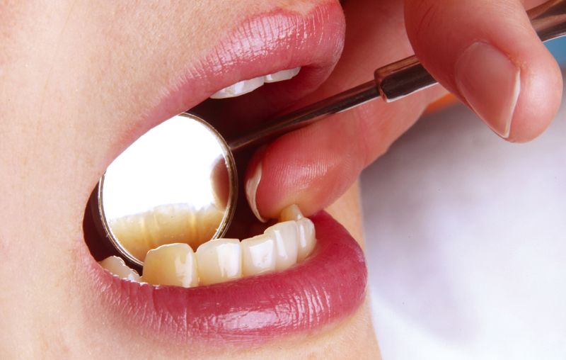 Kontrolle ihrer Zähne in der Zahnarztpraxis Neetze