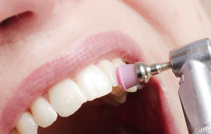 Professionelle Zahnreinigung und Prophylaxe in der Zahnarztpraxis Neetze